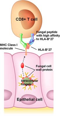 Spondyloarthritis, Acute Anterior Uveitis, and Fungi: Updating the Catterall–King Hypothesis